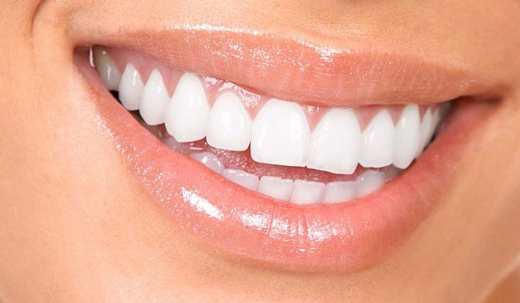 dental implant dentists Warrington