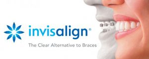 Why Invisalign™ is Better than Cheaper Alternatives