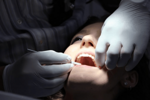 How to Prepare for Your First Root Canal